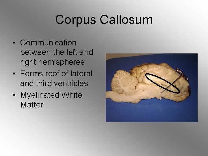 Corpus Callosum • Communication between the left and right hemispheres • Forms roof of