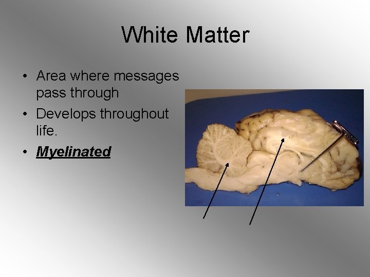 White Matter • Area where messages pass through • Develops throughout life. • Myelinated