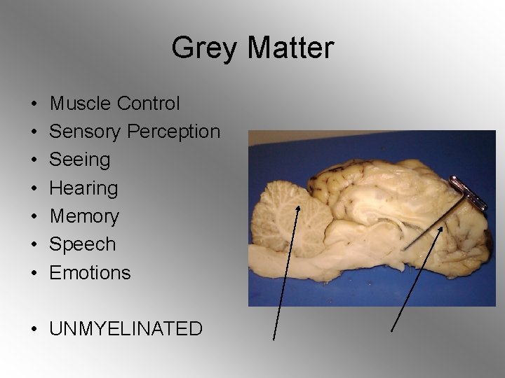 Grey Matter • • Muscle Control Sensory Perception Seeing Hearing Memory Speech Emotions •