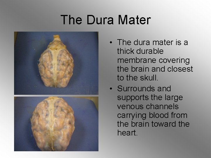 The Dura Mater • The dura mater is a thick durable membrane covering the