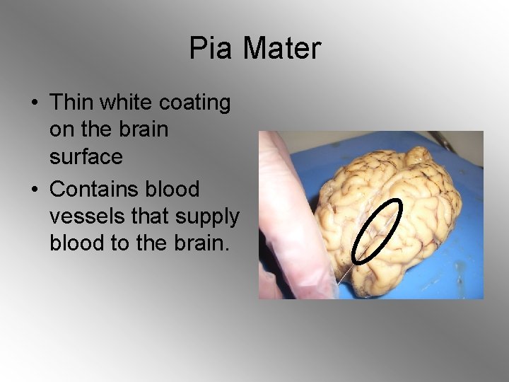 Pia Mater • Thin white coating on the brain surface • Contains blood vessels