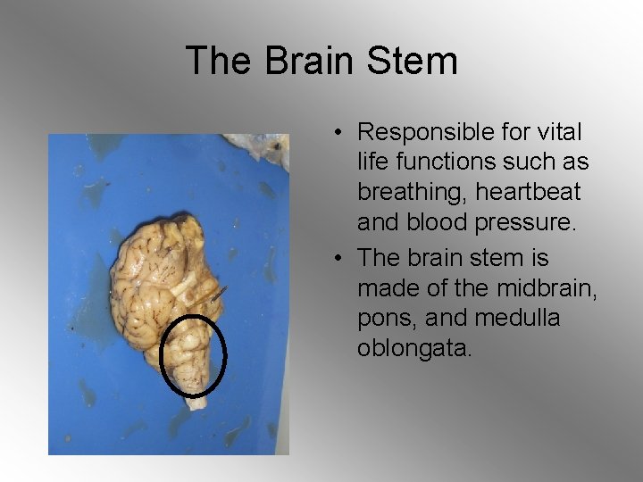 The Brain Stem • Responsible for vital life functions such as breathing, heartbeat and