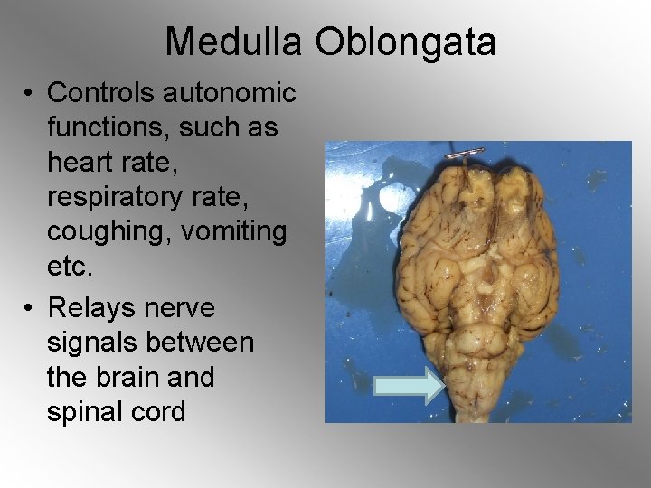 Medulla Oblongata • Controls autonomic functions, such as heart rate, respiratory rate, coughing, vomiting