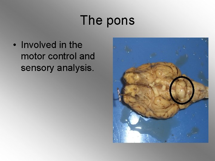 The pons • Involved in the motor control and sensory analysis. 