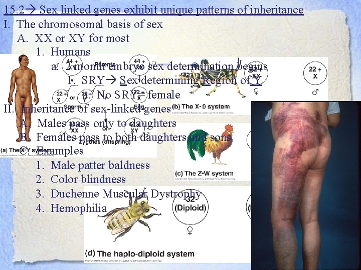 15. 2 Sex linked genes exhibit unique patterns of inheritance I. The chromosomal basis