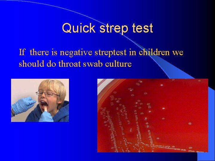 Quick strep test If there is negative streptest in children we should do throat
