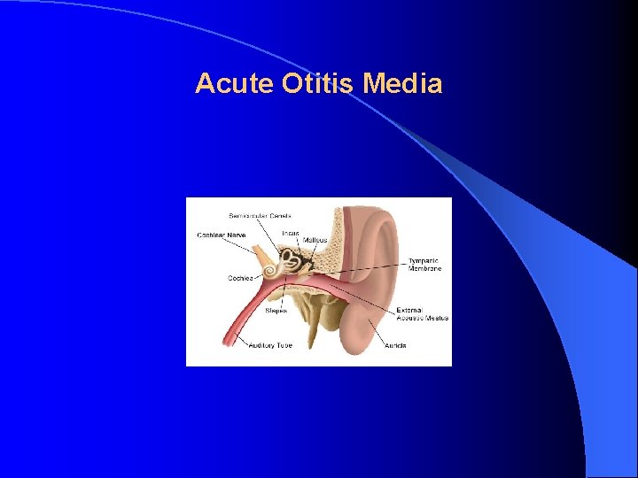 Acute Otitis Media 