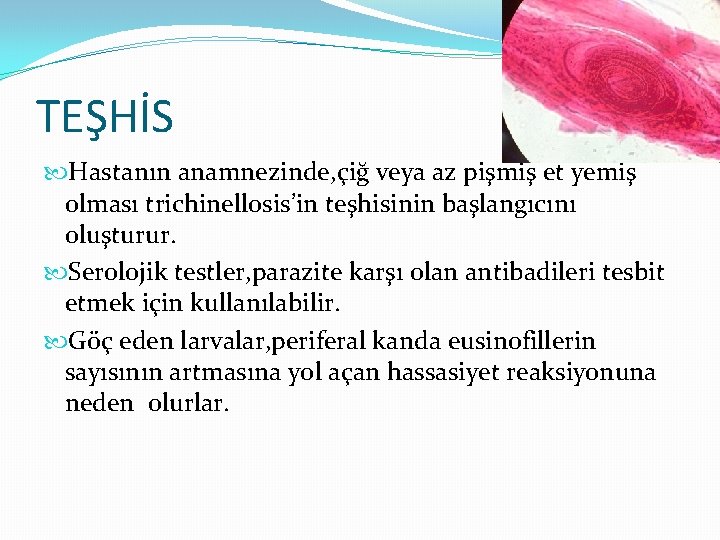 TEŞHİS Hastanın anamnezinde, çiğ veya az pişmiş et yemiş olması trichinellosis’in teşhisinin başlangıcını oluşturur.