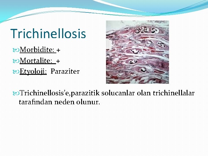 Trichinellosis Morbidite: + Mortalite: + Etyoloji: Paraziter Trichinellosis’e, parazitik solucanlar olan trichinellalar tarafından neden