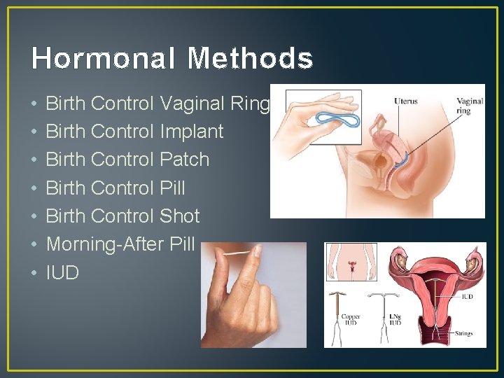 Hormonal Methods • • Birth Control Vaginal Ring Birth Control Implant Birth Control Patch