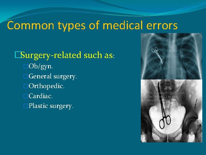 Common types of medical errors �Surgery-related such as: �Ob/gyn. �General surgery. �Orthopedic. �Cardiac. �Plastic