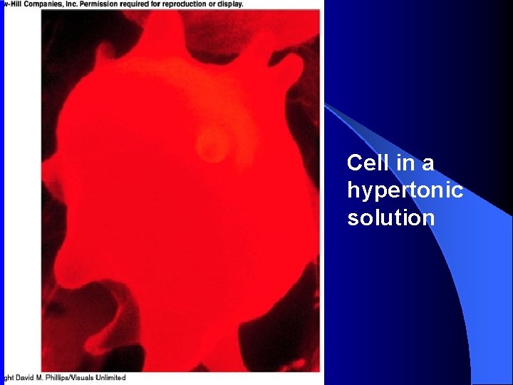 Cell in a hypertonic solution 