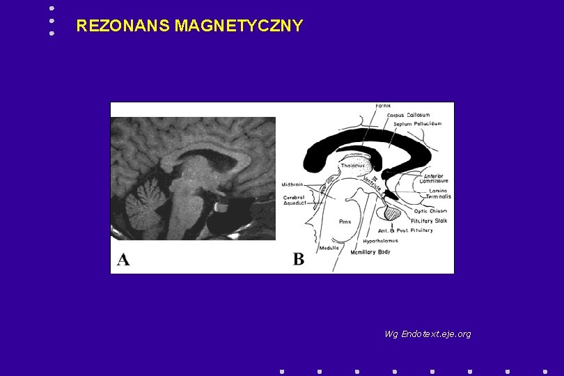 REZONANS MAGNETYCZNY Wg Endotext. eje. org 