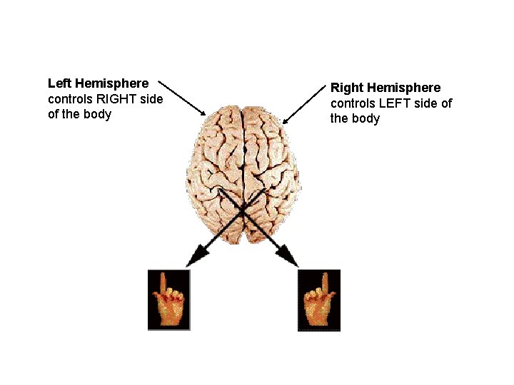 Left Hemisphere controls RIGHT side of the body Right Hemisphere controls LEFT side of