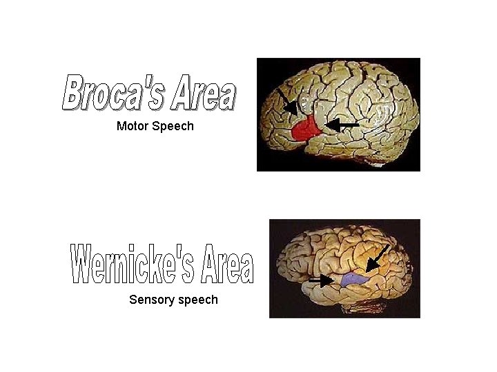 Motor Speech Sensory speech 