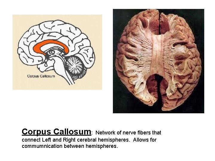 Corpus Callosum: Network of nerve fibers that connect Left and Right cerebral hemispheres. Allows