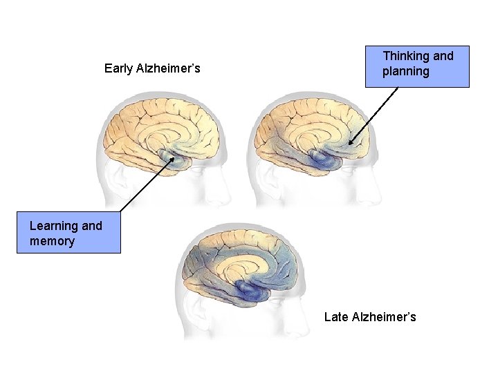 Early Alzheimer’s Thinking and planning Learning and memory Late Alzheimer’s 