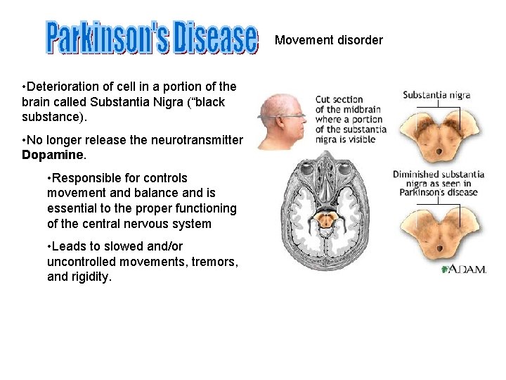 Movement disorder • Deterioration of cell in a portion of the brain called Substantia