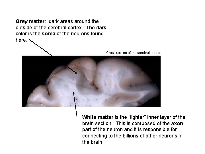 Grey matter: dark areas around the outside of the cerebral cortex. The dark color