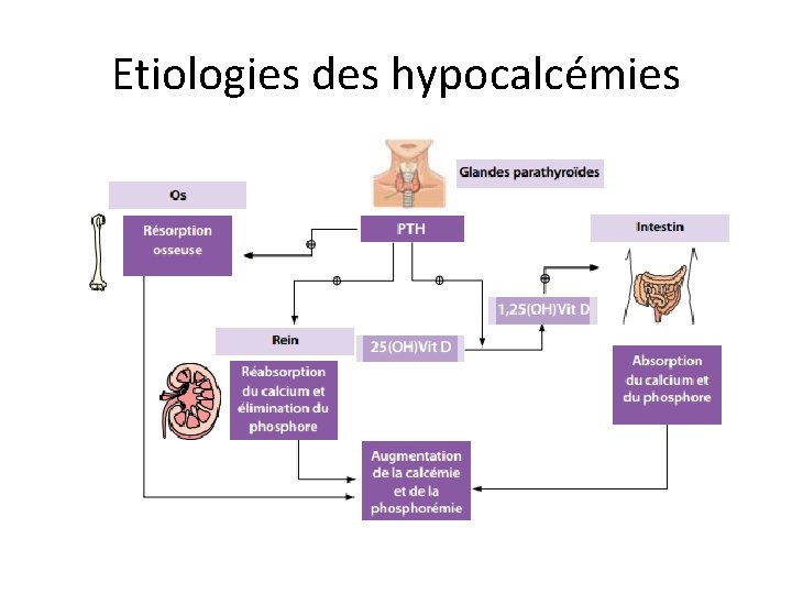 Etiologies des hypocalcémies 