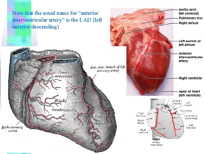 Note that the usual name for “anterior interventricular artery” is the LAD (left anterior