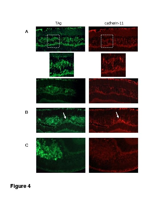 TAg A B C Figure 4 cadherin-11 