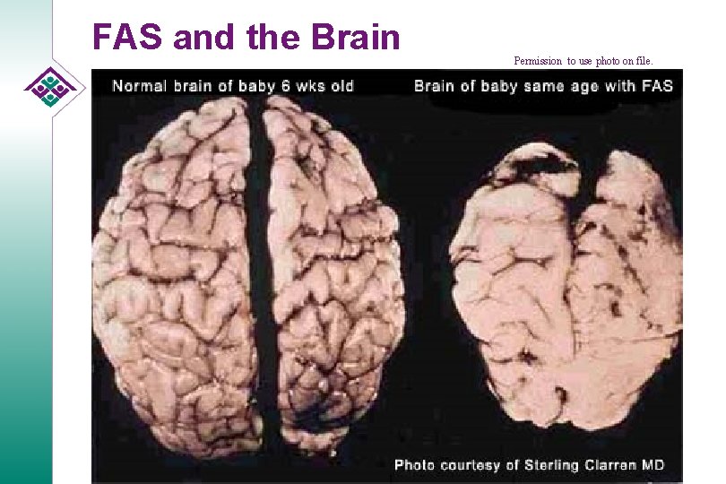 FAS and the Brain Permission to use photo on file. 