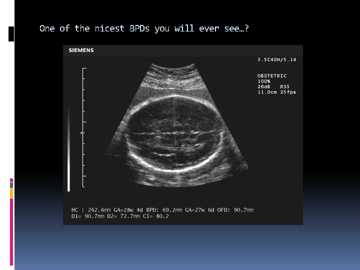 One of the nicest BPDs you will ever see…? 