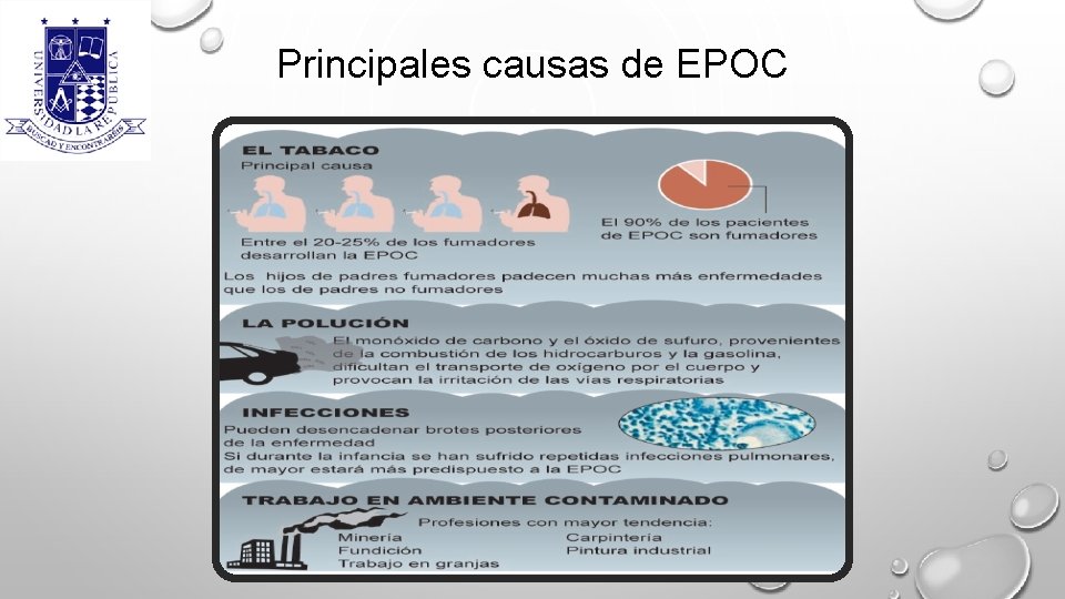 Principales causas de EPOC 