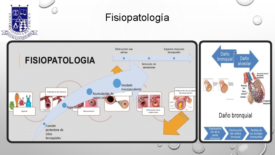 Fisiopatología 