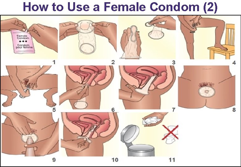 How to Use a Female Condom (2) 