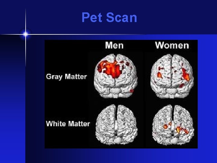 Pet Scan 