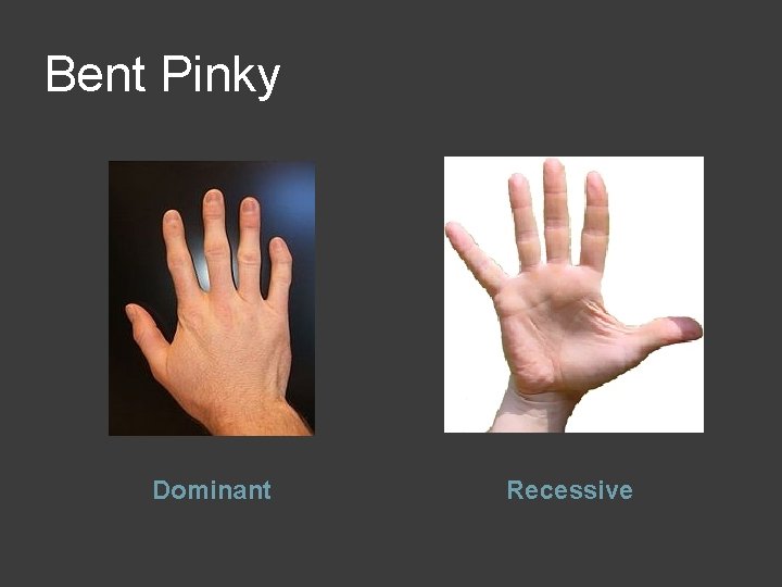 Bent Pinky Dominant Recessive 