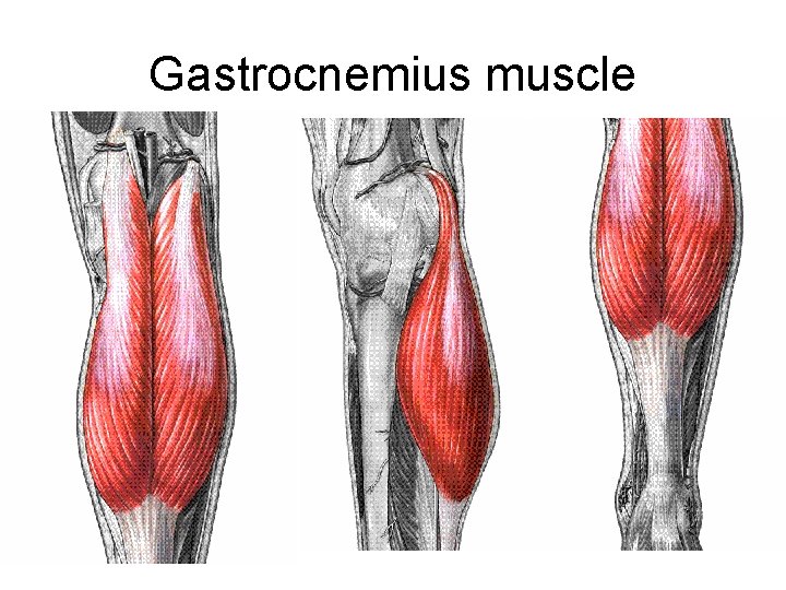 Gastrocnemius muscle 