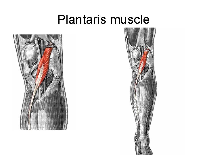 Plantaris muscle 