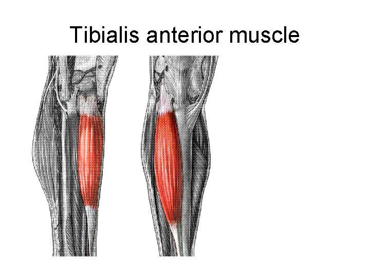 Tibialis anterior muscle 