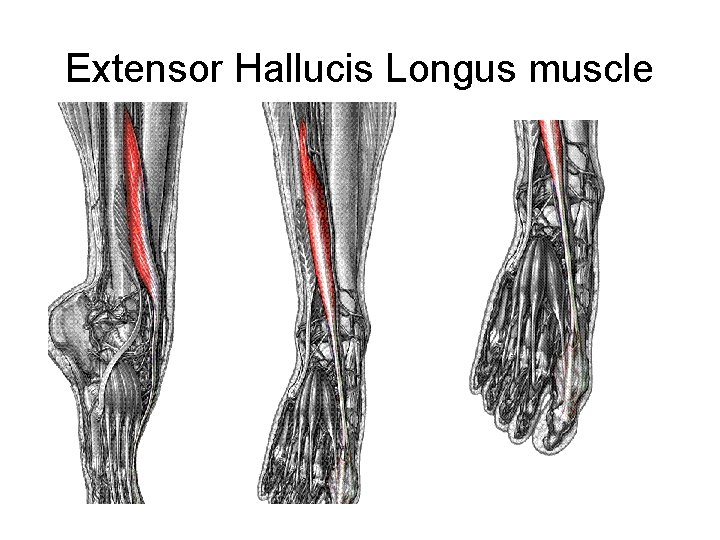 Extensor Hallucis Longus muscle 