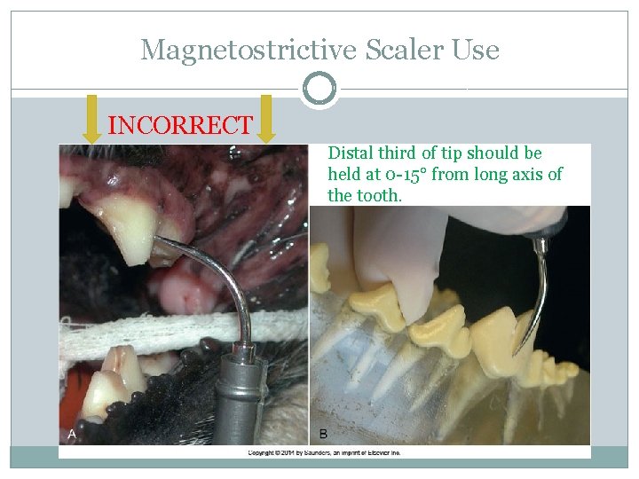 Magnetostrictive Scaler Use INCORRECT Distal third of tip should be held at 0 -15°