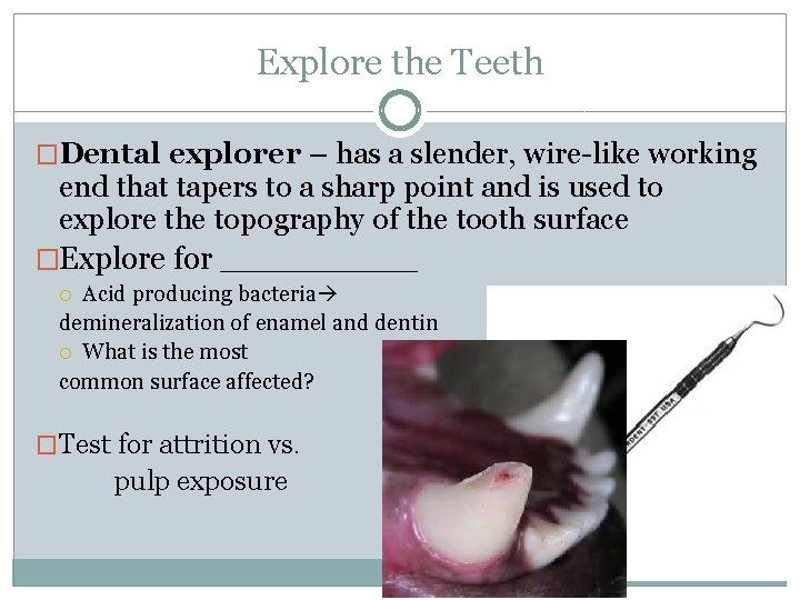 Explore the Teeth �Dental explorer – has a slender, wire-like working end that tapers