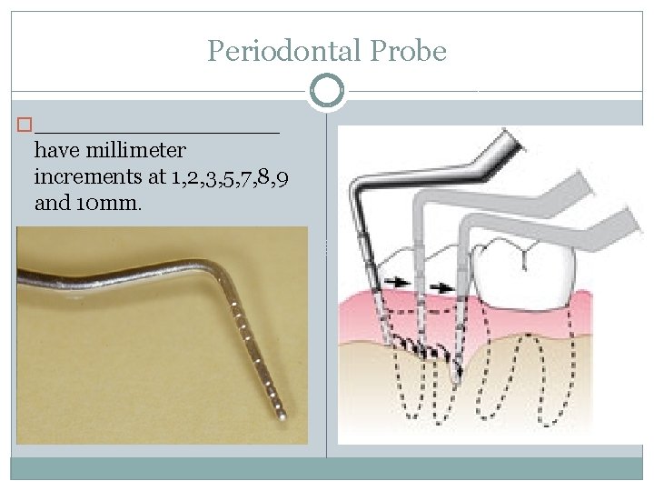 Periodontal Probe � ________ have millimeter increments at 1, 2, 3, 5, 7, 8,