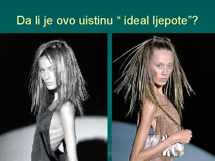 Da li je ovo uistinu “ ideal ljepote”? 