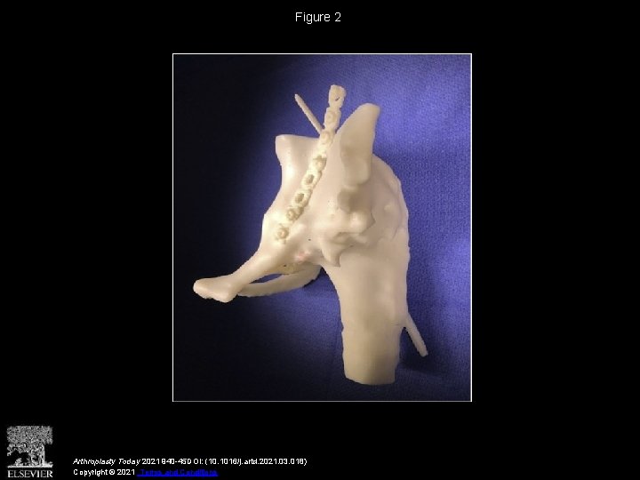Figure 2 Arthroplasty Today 2021 940 -45 DOI: (10. 1016/j. artd. 2021. 03. 018)