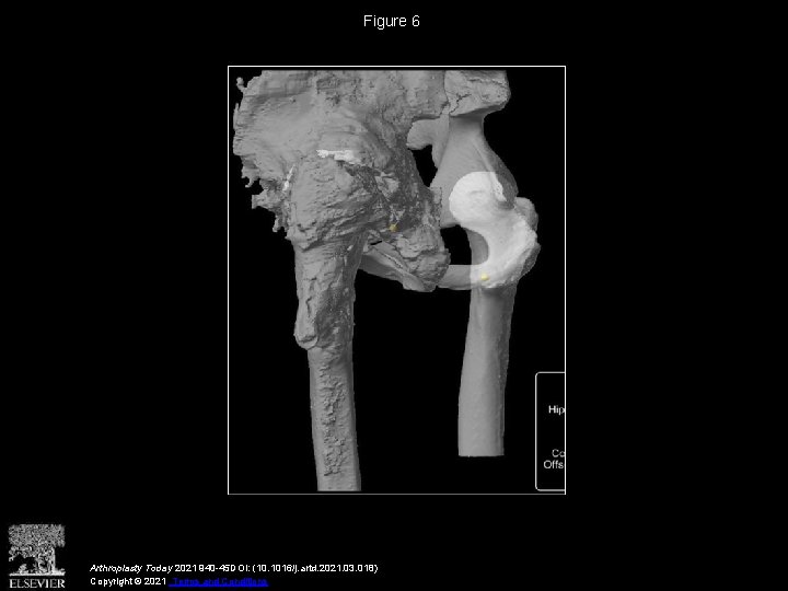 Figure 6 Arthroplasty Today 2021 940 -45 DOI: (10. 1016/j. artd. 2021. 03. 018)