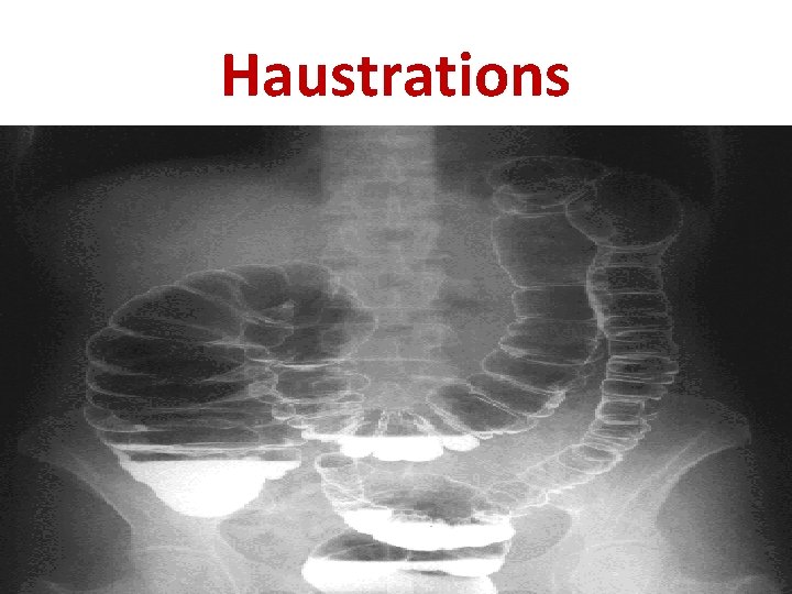 Haustrations 