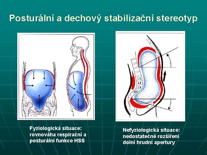 Posturální a dechový stabilizační stereotyp Fyziologická situace: rovnováha respirační a posturální funkce HSS Nefyziologická