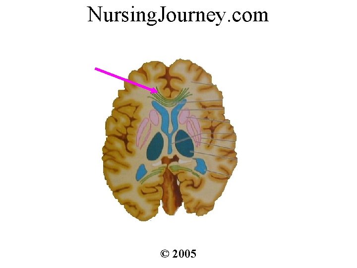Nursing. Journey. com © 2005 