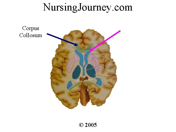Nursing. Journey. com Corpus Collosum © 2005 