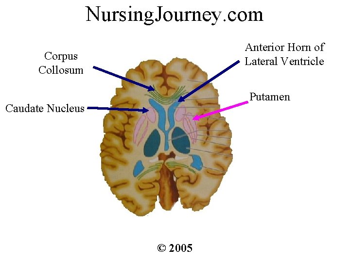 Nursing. Journey. com Anterior Horn of Lateral Ventricle Corpus Collosum Putamen Caudate Nucleus ©