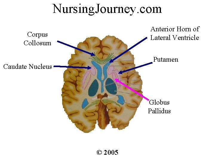 Nursing. Journey. com Anterior Horn of Lateral Ventricle Corpus Collosum Putamen Caudate Nucleus Globus