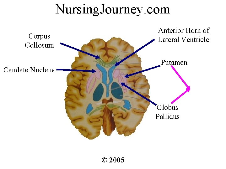 Nursing. Journey. com Anterior Horn of Lateral Ventricle Corpus Collosum Putamen Caudate Nucleus Globus